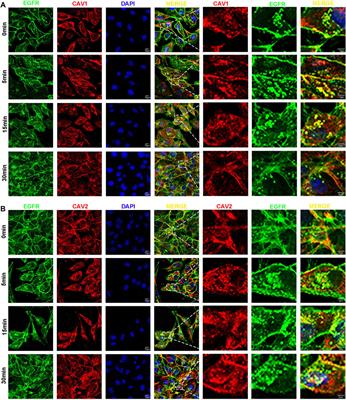 Identification and validation of a prognostic risk model based on caveolin family genes for breast cancer